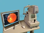 Topcon Trc NW200 Non Myd Fundus Camera W/ Windows 7 + Lombart Digital Video Sys.. Fixed Price $8950.00.